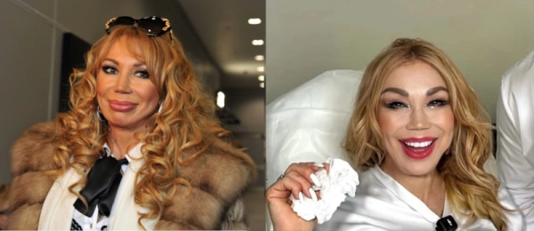 «Минус 20 лет»: хирург раскрыл секрет омоложения Маши Распутиной после тайной свадьбы