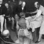 Самый быстрый хирург в истории: почему операция Роберта Листона привела к 300% смертности