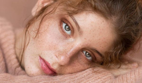 Первые лучи — первые пигментные пятна: как избежать пигментации с приходом весны